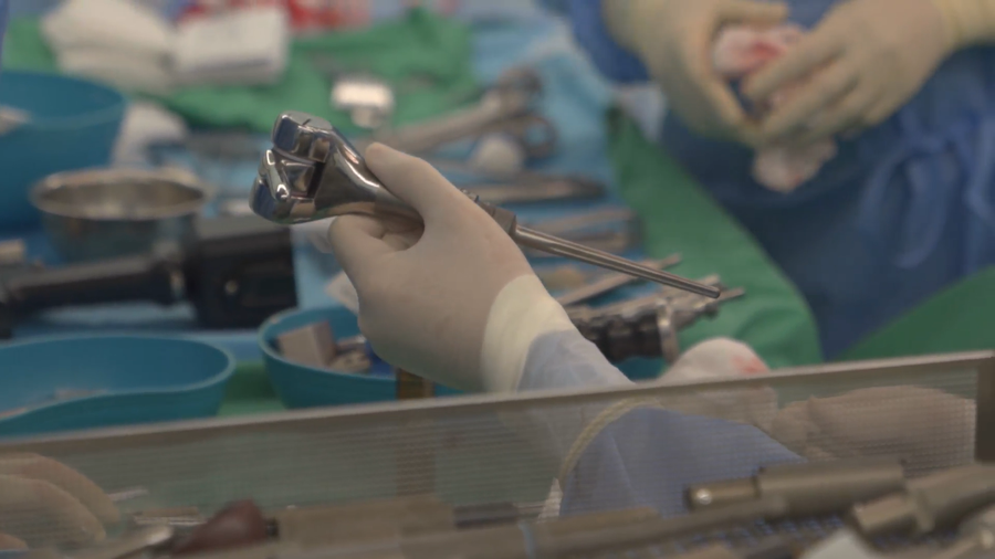 Khớp tăng trưởng in 3D được thiết kế riêng cho bệnh nhi. Khớp tăng trưởng in 3D được thiết kế riêng cho bệnh nhi.