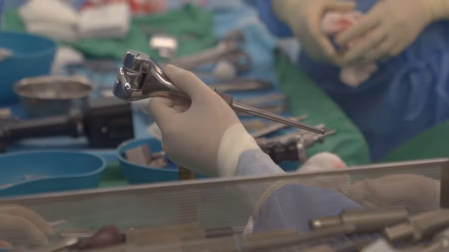 Khớp tăng trưởng in 3D được thiết kế riêng cho bệnh nhi.