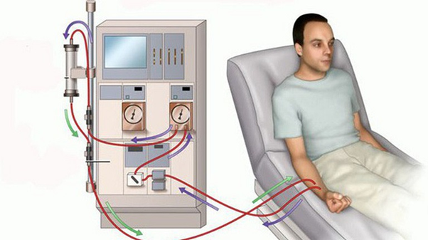 Cách trị suy thận hiện nay và giải pháp mới mang tên Ích Thận Vương ảnh 2 Cách trị suy thận hiện nay và giải pháp mới mang tên Ích Thận Vương ảnh 2