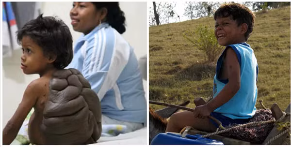 Những vết bớt kỳ lạ khiến bạn ngỡ ngàng khi nhìn thấy - Ảnh 7.