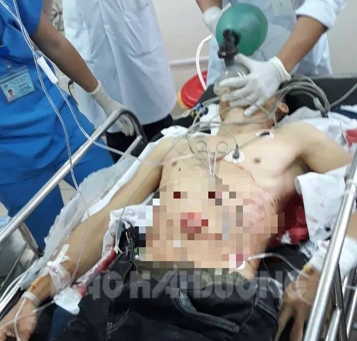 Chu Đăng Khoa đã tử vong vào tối 21.11 sau khi dùng dao tự đâm vào người mình ngày 14.11. (Ảnh: Báo Hải Dương).