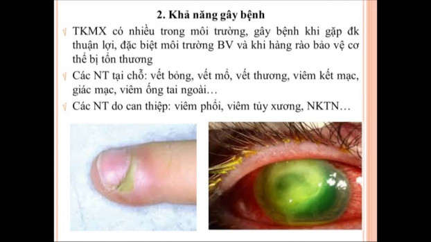 Học sinh Hà Nội uống nước nhiễm khuẩn mủ xanh nguy hiểm thế nào?