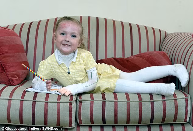 Da của Jasmine có thể bong tróc chỉ vì một vết xước nhỏ.