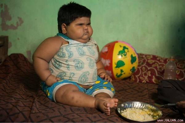 Bé Aliya Saleem 18 tháng tuổi nặng 24kg (Ảnh: New York Post)