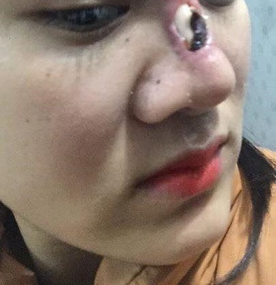 Phẫu thuật thẩm mỹ luôn tiềm ẩn kết quả không như mong muốn.