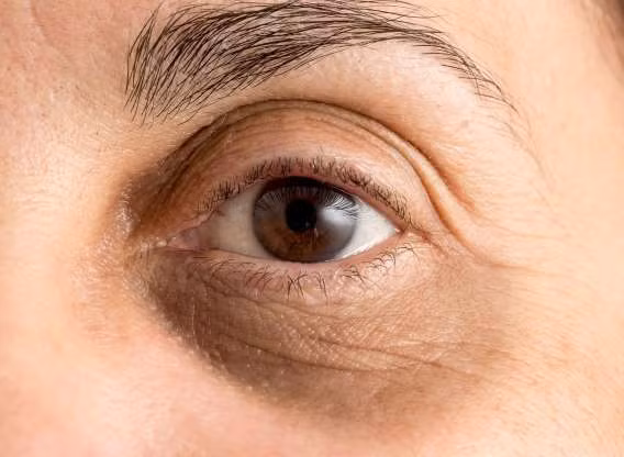 nhung dau hieu bao dong khi ban khong uong du nuoc hinh 9