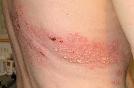 zona-than-kinh-drbacsicom2-1012