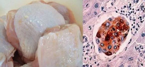 ung thư 2 ung thư, ăn uống, thực phẩm