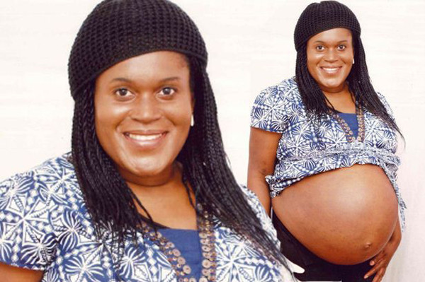 Bà Beryl và chiếc bụng to vì khối u xơ tử cung phát triển lớn gấp 2 đến 3 lần bình thường. Ảnh:Mirror bung-to-nhu-bau-8-thang-vi-khoi-u-xo-tu-cung