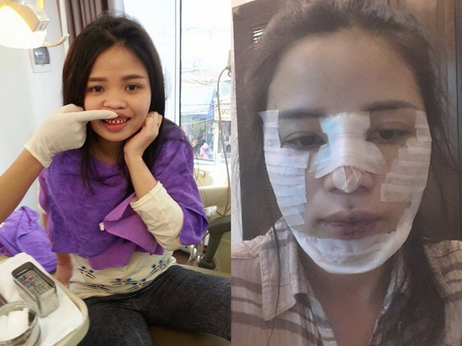 Thạc sĩ được chồng chi 200 triệu đồng phẫu thuật thẩm mỹ