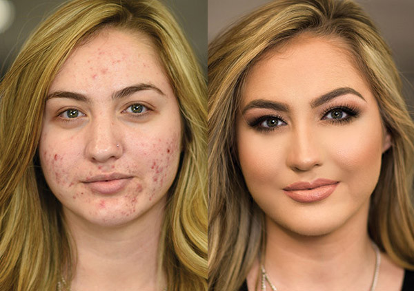 Kỹ năng trang điểm che mụn “thần thánh” khó tin ảnh 8