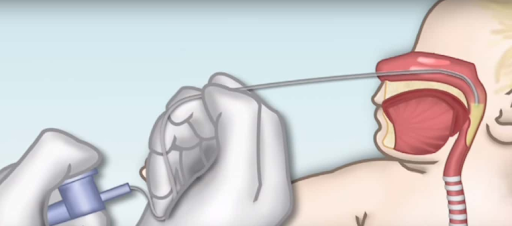 6 cách rửa mũi cho trẻ sơ sinh và trẻ nhỏ sạch, hết bẩn ảnh 2 6 cách rửa mũi cho trẻ sơ sinh và trẻ nhỏ sạch, hết bẩn ảnh 2