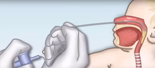 6 cách rửa mũi cho trẻ sơ sinh và trẻ nhỏ sạch, hết bẩn ảnh 2