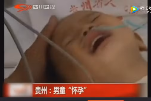 Bé trai 2 tuổi đột nhiên 