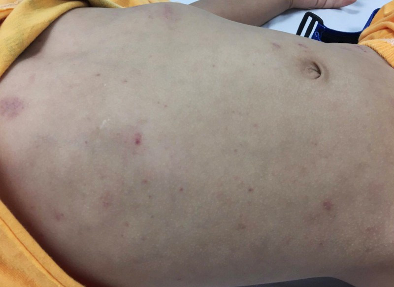 16776385_10211307642514045_1605036181_o.jpg 16776385_10211307642514045_1605036181_o.jpg