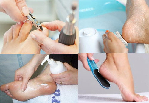 Mẹo giữ đôi bàn chân đẹp mùa mưa Meo-giu-doi-ban-chan-dep-mua-mua-2
