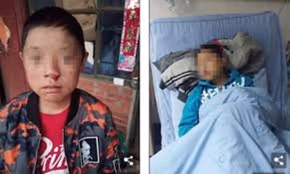 Gần đây, bệnh tình của Xiao Luo bắt đầu trở nặng.