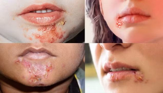 choc mep do dau va cach chua tri nhanh nhat tai nha - 3