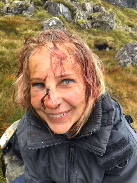 Magdalena cười rạng rỡ trong bức ảnh chụp sau khi ngã núi