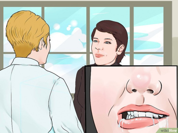 Kỹ năng sơ cứu: Cách phòng và xử lý khi bị co giật, lên cơn động kinh 7