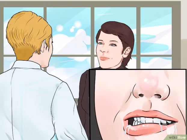 Cách phòng và xử lý khi bị co giật, lên cơn động kinh ảnh 8 Kỹ năng sơ cứu: Cách phòng và xử lý khi bị co giật, lên cơn động kinh 7