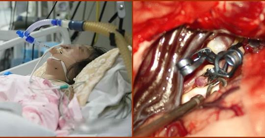 Đi khám đau đầu, người phụ nữ nhận được tin dữ “chỉ còn 24 giờ để sống”