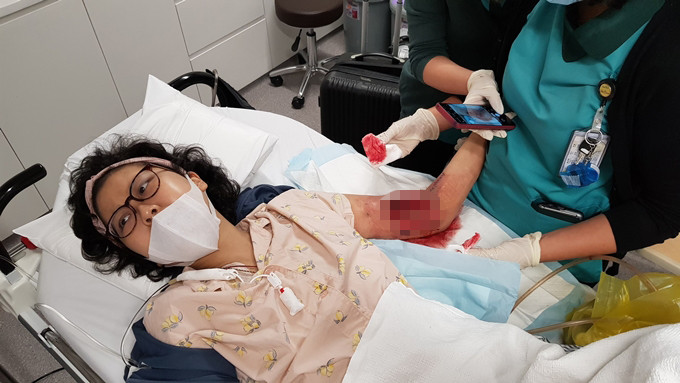 Đầu tháng 3/2019, bác sĩ phát hiện Hạnh An nhiễm loại vi khuẩn ăn thịt khiến hoại tử một phần cánh tay trái. Họnhanh chóng quyết định cho em lên bàn mổ sau đó điều trị kháng sinh liều cao và truyền thuốc suốt 12 ngày liên tục. An kiệt quệ, không thể đứng dậy, mọi sinh hoạt như ăn uống, đi vệ sinh, được thực hiện trên giường với sự hỗ trợ của bố.