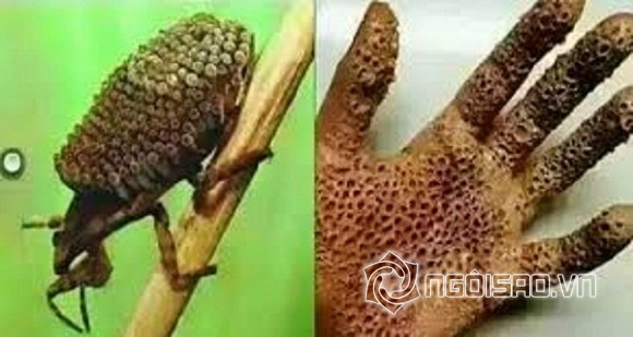 côn trùng gây bỏng da chết người 0 côn trùng gây bỏng da chết người 0