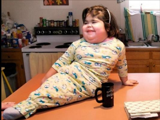 Sức sống thần kì của bé gái có đôi chân dính liền như đuôi cá ảnh 3 Sức sống thần kì của bé gái có đôi chân dính liền như đuôi cá ảnh 3