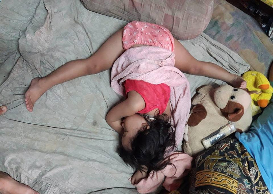Con gái đang ngủ ngon trên võng, mẹ thót tim phát hiện chi tiết bất thường ảnh 2 con gai ngu ngon lanh tren vong, me giat thot minh khi nhin ki hon - 2