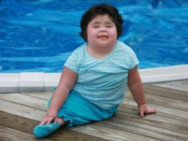 Sức sống thần kì của bé gái có đôi chân dính liền như đuôi cá ảnh 2 Sức sống thần kì của bé gái có đôi chân dính liền như đuôi cá ảnh 2