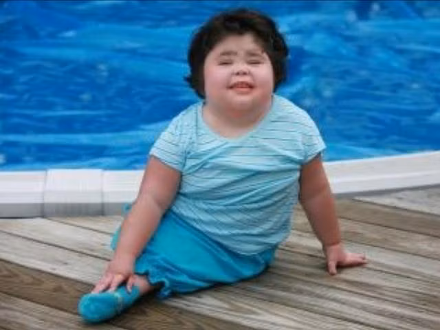 Sức sống thần kì của bé gái có đôi chân dính liền như đuôi cá ảnh 2