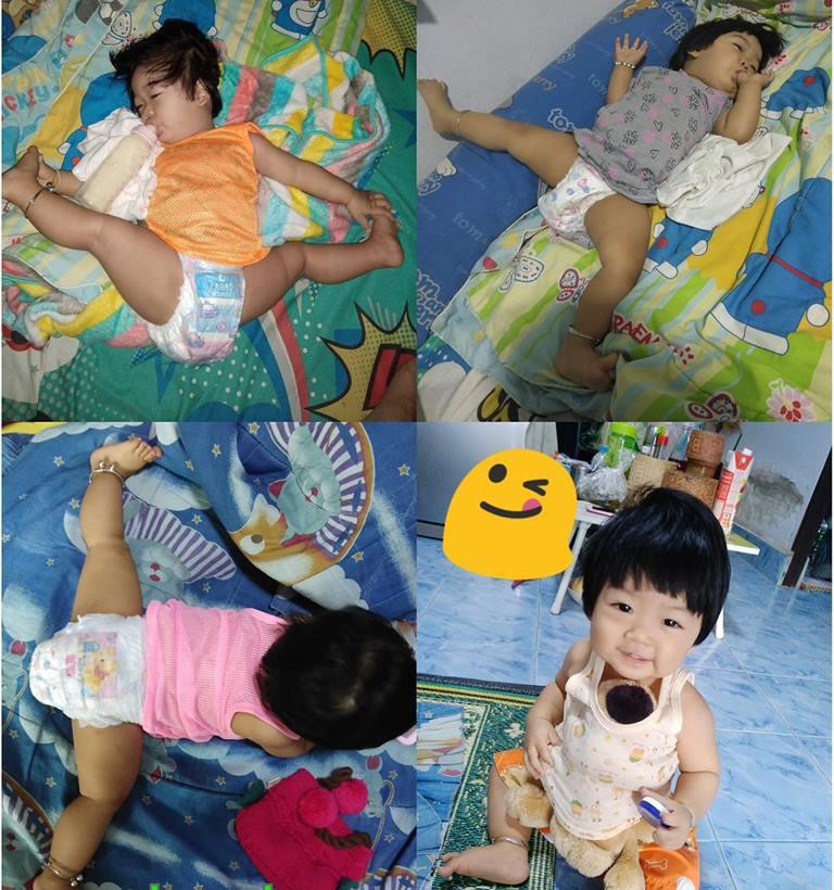 Con gái đang ngủ ngon trên võng, mẹ thót tim phát hiện chi tiết bất thường ảnh 7 con gai ngu ngon lanh tren vong, me giat thot minh khi nhin ki hon - 7