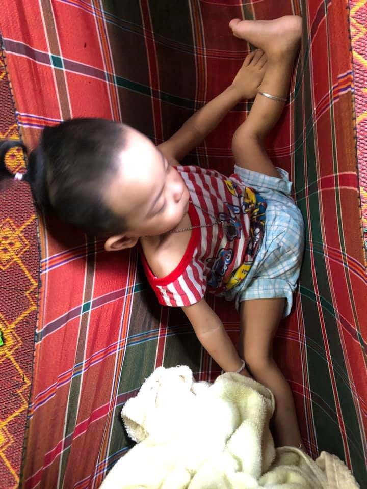 Con gái đang ngủ ngon trên võng, mẹ thót tim phát hiện chi tiết bất thường ảnh 8 con gai ngu ngon lanh tren vong, me giat thot minh khi nhin ki hon - 8