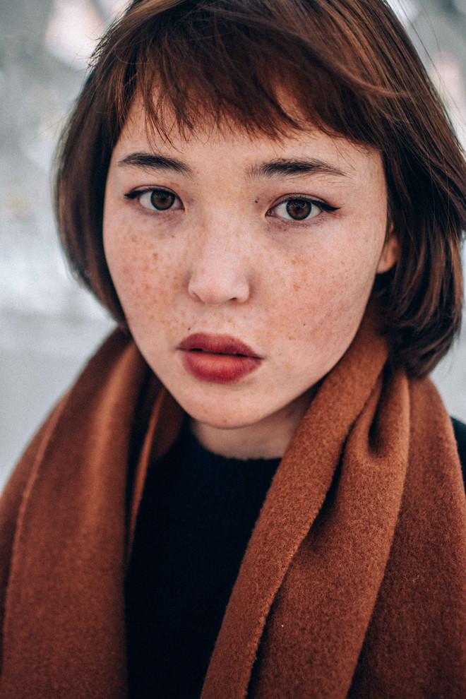 Da thiếu vitamin E dễ bị nám và tàn nhang.Ảnh:Unsplash. Vitamin E va tac dung than ky trong viec lam dep da, chong lao hoa hinh anh 1