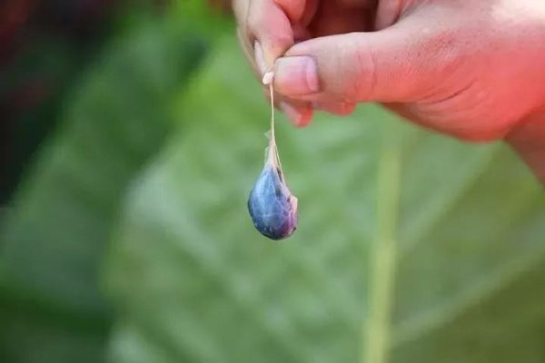 Con trai 28 tuổi bị “ăn” mất não, bác sĩ nói nguyên nhân khiến cha đau đớn vì hối hận ảnh 1 chang trai 28 tuoi bi "an" mat nao, bac si noi nguyen nhan khien nguoi cha lap tuc hoi han - 3