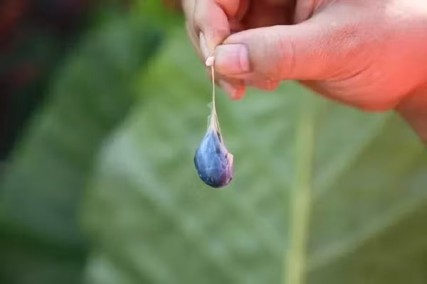 chang trai 28 tuoi bi "an" mat nao, bac si noi nguyen nhan khien nguoi cha lap tuc hoi han - 3