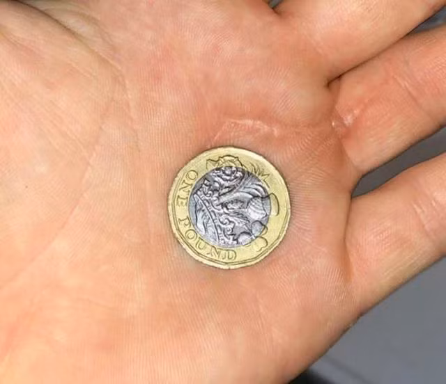 Nghịch dại, người đàn ông nuốt cả đồng xu rồi bị kẹt trong thực quản - 3