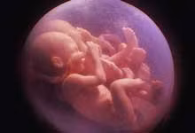 ky-la-co-gai-sinh-3-nhung-3-dua-tre-chi-cung-me-khac-cha-blogtamsu2