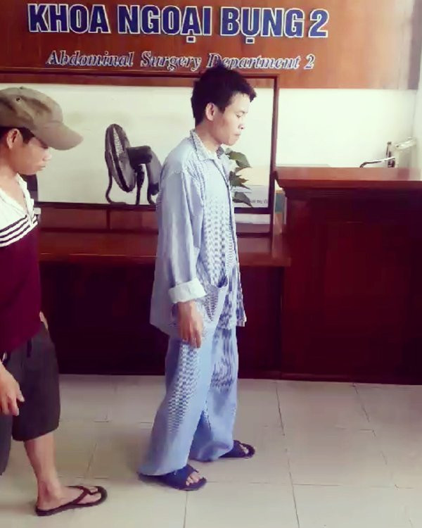 khối u,khớp háng,bệnh viện K khối u,khớp háng,bệnh viện K