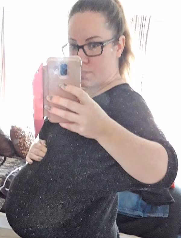 phau thuat bo thai ve van thay nghen, me nhap vien kham bac si cung phai ngo ngang - 2