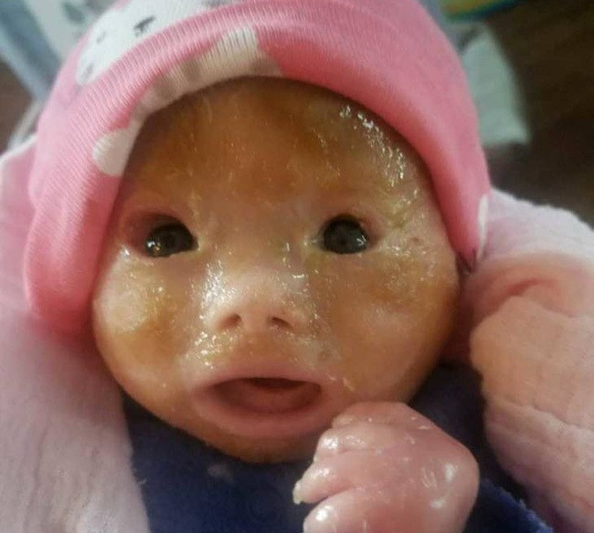 Mẹ lặng người khi nhìn thấy khuôn mặt kỳ lạ của con gái vừa chào đời