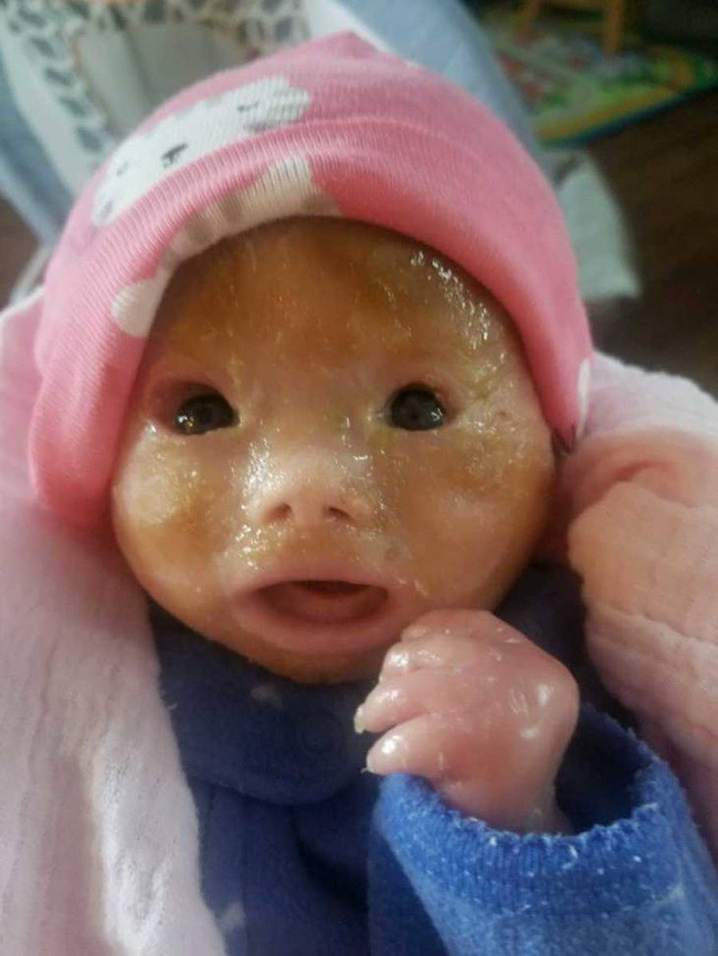 Mong đợi ngày con gái chào đời, mẹ lặng người khi lần đầu nhìn thấy khuôn mặt con - Ảnh 2. Mong đợi ngày con gái chào đời, mẹ lặng người khi lần đầu nhìn thấy khuôn mặt con-2