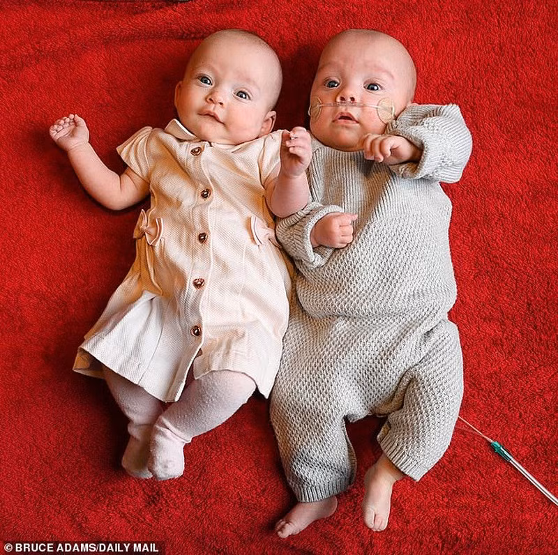 Kì lạ cặp song sinh ra đời cách nhau 12 ngày - ảnh 2