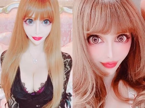 Gương mặt của Vanilla sau khi trải qua nhiều cuộc phẫu thuật.