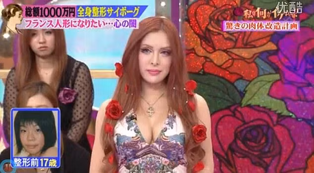 Nu nguoi mau bien thanh bup be song sau hang tram ca phau thuat hinh anh 2 