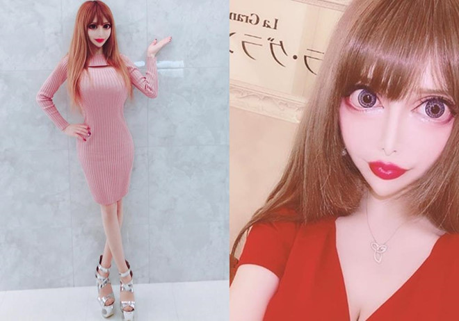 Nu nguoi mau bien thanh bup be song sau hang tram ca phau thuat hinh anh 3 