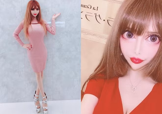 Nu nguoi mau bien thanh bup be song sau hang tram ca phau thuat hinh anh 3 