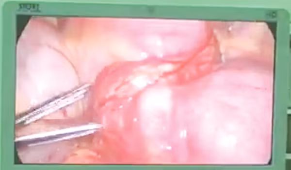 hiem-hoa-tu-nhung-chiec-tam-1