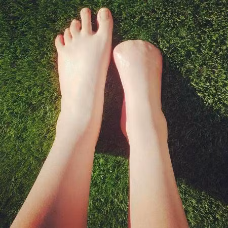 Đi spa cá rỉa, cô gái bị cắt cụt hết ngón chân 